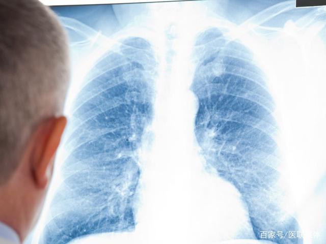 得了肺癌，要注意转移！这四个器官是肺癌最先转移的部位。 